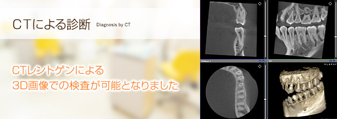 ＣＴによる診断